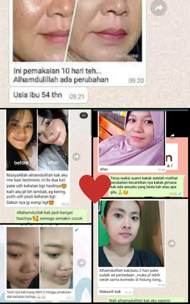 Testimoni